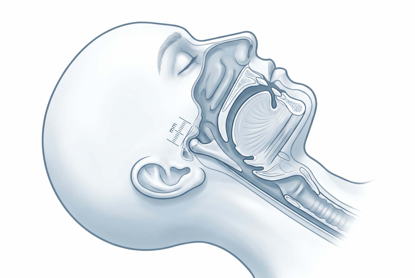 Cross-section diagram of a sleeping profile with the lower jaw held forward and the airway open